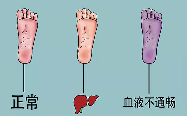 糖尿病秋分时节，养生保健注意啥？