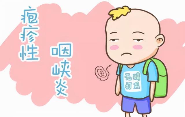 疱疹性咽峡炎进入高发期，如何防治看这里