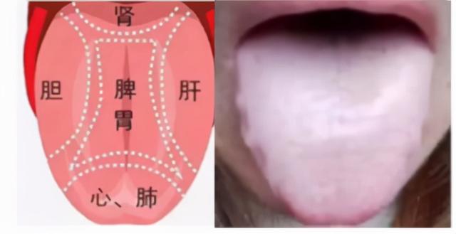 中医教你看舌诊，这几种情况要注意