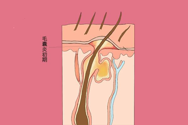 为什么头皮上总能摸到小疙瘩？影响健康吗？提醒：别用手抠