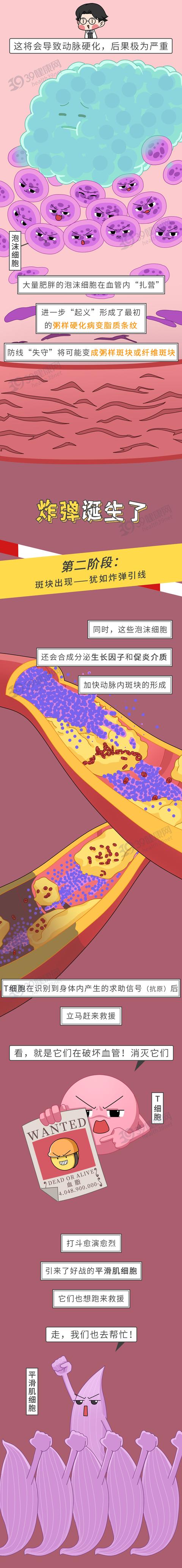 每年1790万人死于心血管疾病，这4类人群需提高警惕，降低血脂