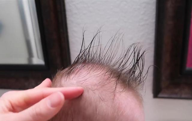 没头发的宝宝是发育晚吗?