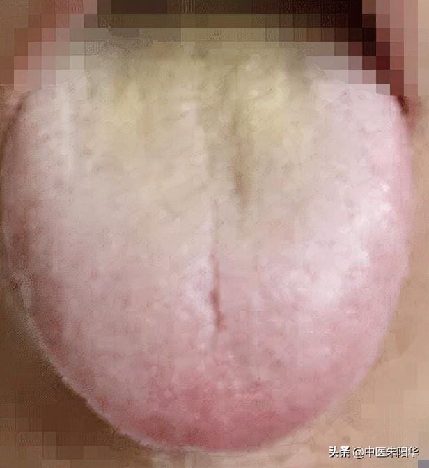 对镜查舌早知病！中医教您如何通过舌头快速识别疾病