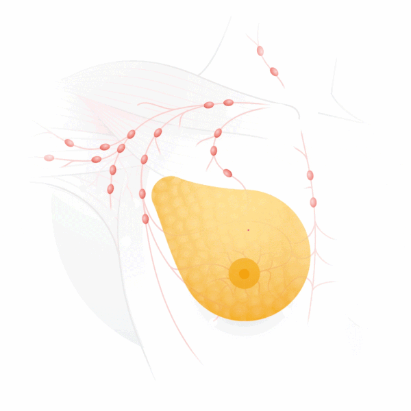 能检测乳腺癌，还能让渐冻症患者“开口说话”，谷歌这次有点东西