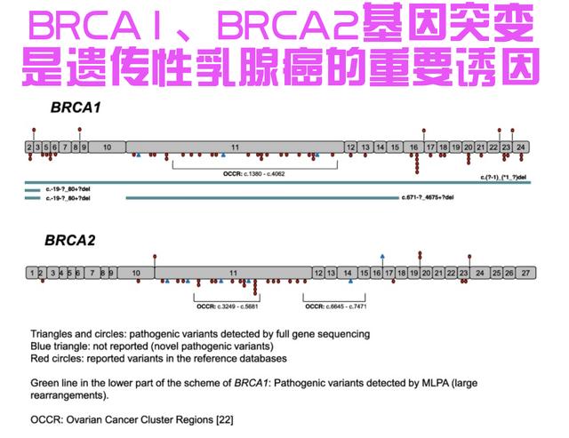 女性健康頭號殺手 乳腺癌成為全球第一癌症 7種方法遠離乳腺癌 Kks資訊網