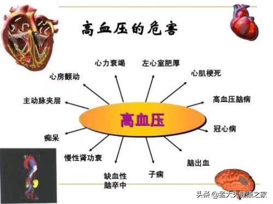 家里老人突发脑溢血，懂得急救很重要：4个步骤记清楚，能救命