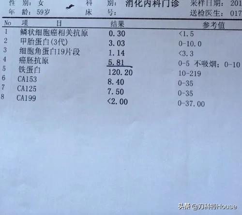体检发现cea升高是癌症吗 该咋办 新闻时间