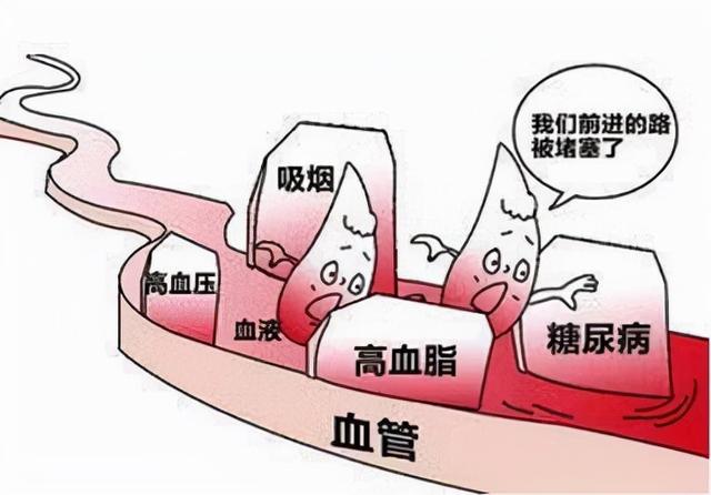 五种常见的心血管疾病图片