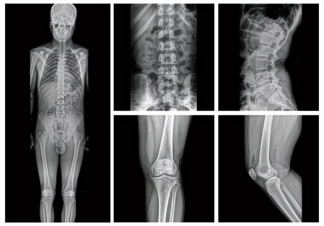 天医云智慧医疗再发力，人工智能精准赋能医学影像