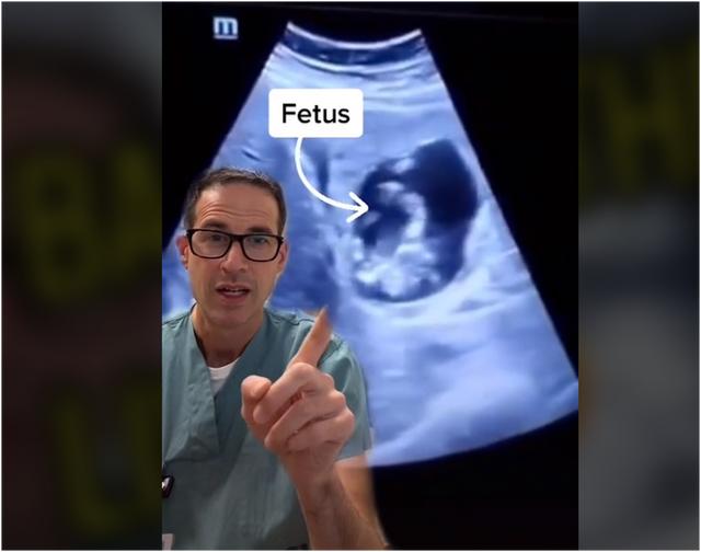 它也可以孕育生命？加拿大女子怀孕后子宫内不见胎儿，医生一看肝脏惊呆了