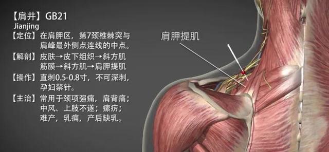 肩井穴—颈项强痛