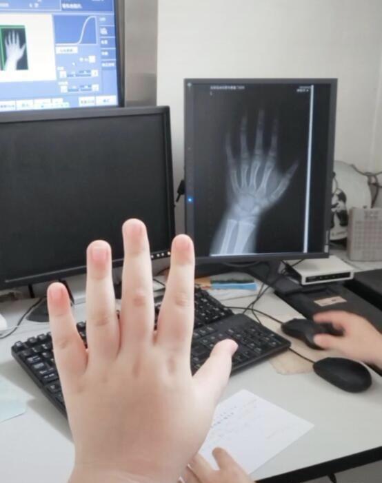 3岁孩子身高低于标准5厘米，医生朋友：孩子想长高需远离4种食物