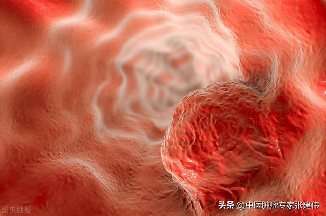 吞干饅頭可自測食管癌？醫生：出現這幾個“信號”趕緊就醫
