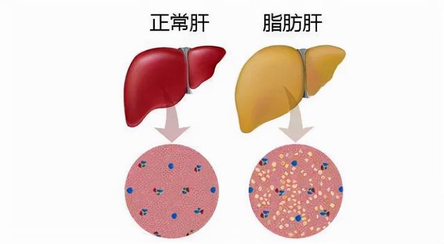 体检报告中的常见病
