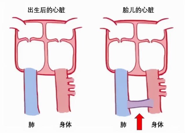 心脏是怎么长大的：第2篇——满是“漏洞”的心脏