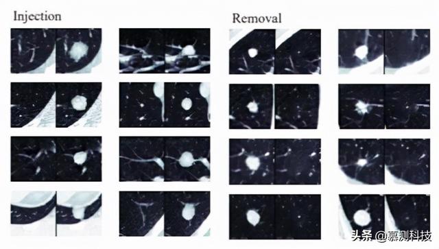 CT-GAN：利用深度学习恶意篡改三维医学图像
