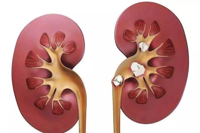 大吃大喝不用愁？只要天天喝苏打水，“痛风”就不会找上你？