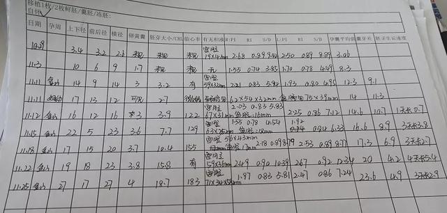 「保胎日记」多磨难迎来我的小天使，遇见木木真幸运