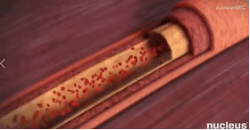 好好的血管怎么就堵了？这些“通血管”方法坑你没商量！