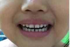 ​孙俪一招吓得孩子乖乖刷牙，获全网10w赞