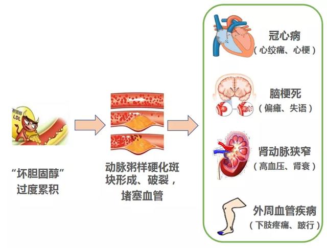 好好的血管怎么就堵了？这些“通血管”方法坑你没商量！