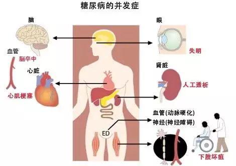 2型糖尿病不控制能活多久？糖尿病人如何长寿？