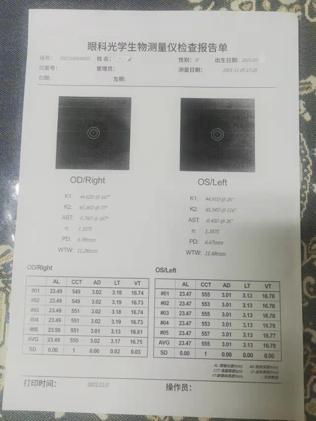 不到6岁的孩子近视了，我选择了和医生相反的建议
