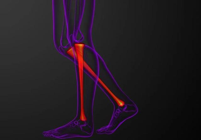 走路腿疼，走走又停停，警惕是这种病