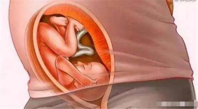 孕期身体的变化，看完还敢拼二胎三胎吗？