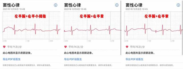 等了 3 年，国行版 Apple Watch 心电图功能终于来了