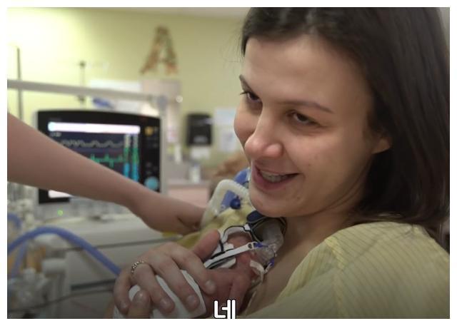 26周早产儿，出生不到1斤只有巴掌大，奇迹生还长成大美人