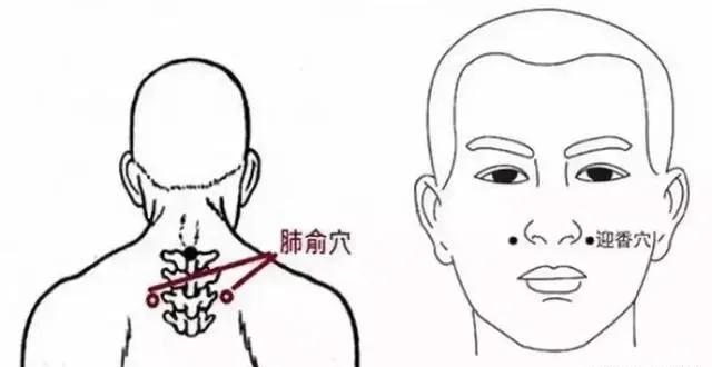 养肺护肺记住“四避五养”