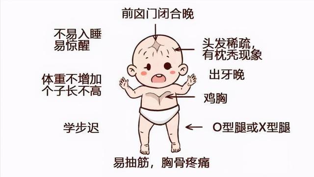 婴幼儿佝偻病有什么症状宝宝有这些症状可能是患了佝偻病