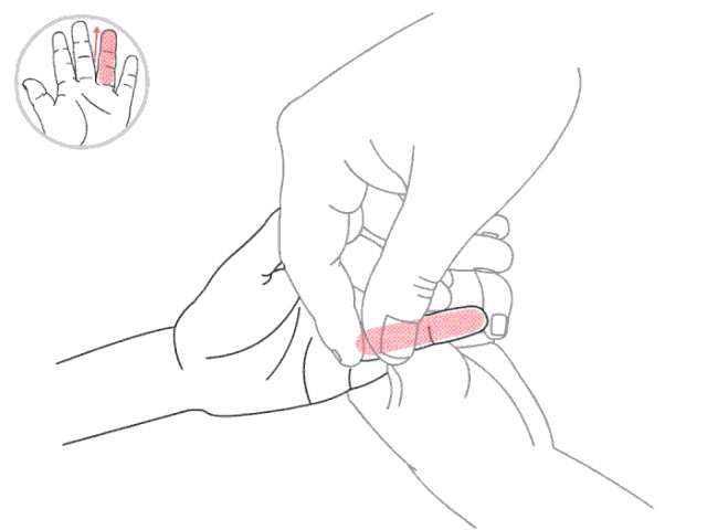 看症状辨清什么是风寒咳嗽？才好对症“施法”