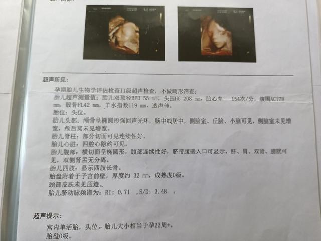 孕40周，16次产检，一路绿灯，一共花费4402.19元