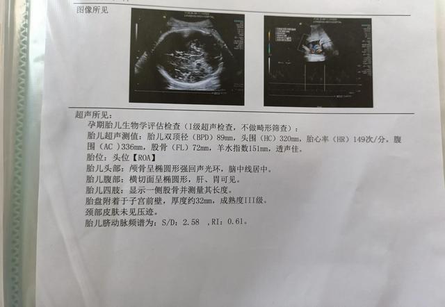 孕40周，16次产检，一路绿灯，一共花费4402.19元