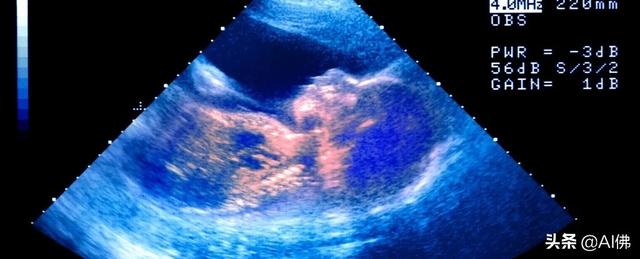 婴儿在子宫里会哭吗？超声波显示一些奇怪的事情正在发生