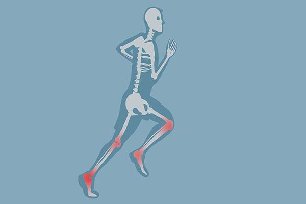 老人骨折后，多喝骨汤真的能补钙？想要促进骨骼愈合要注意2点