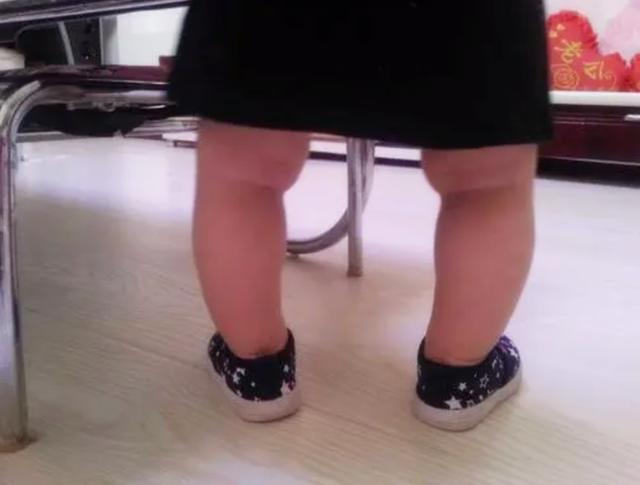 孕期胎儿一直处于“臀位”，会影响以后的腿部发育？医生给出答案