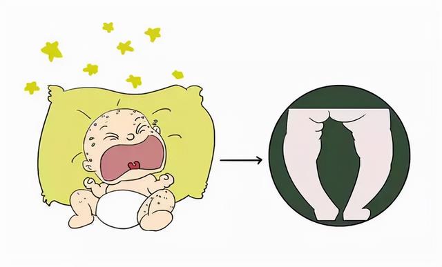 医生提醒：婴幼儿的这些表现，或是佝偻病的征兆！家长注意到了吗