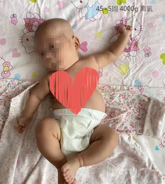 巴掌大超早产宝宝，152天“生命闯关”