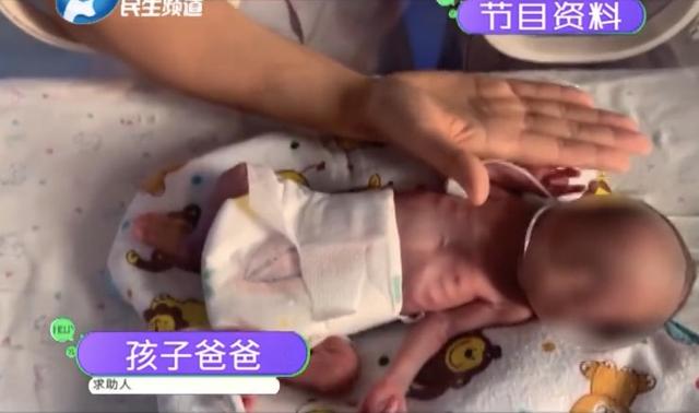 河南滑县“拇指姑娘”出生，体重仅790g