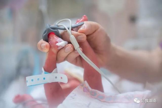 世界早产儿日｜不用怕，早到的天使