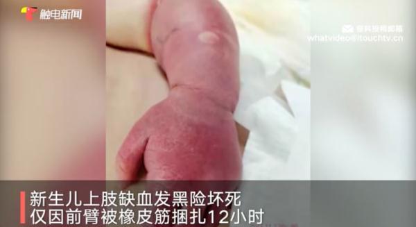只因宝妈一个疏忽，湖南新生1天婴儿险截肢，这些日用品的危险性千万别忽视