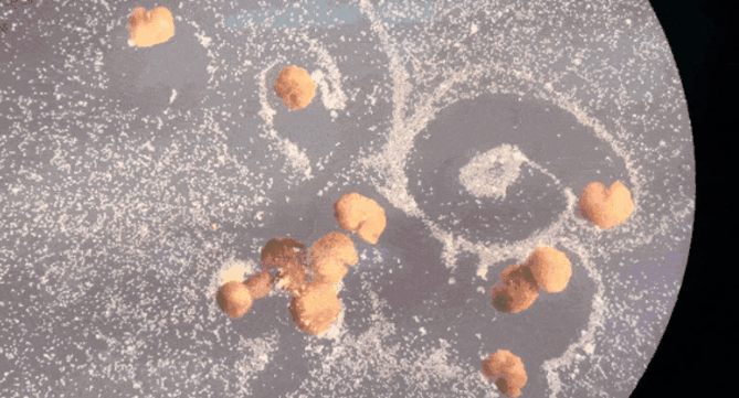 你留言的网易云音乐，上市了 / 青春痘疫苗，后年可以打