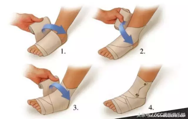 究竟该怎么治愈扭伤的脚踝?
