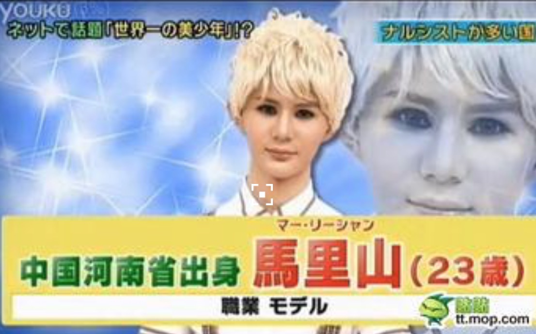 他被稱為世界第一美少年，上日本節目被誤認女性，如今落魄的不行
