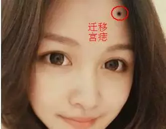 驿马痣相书言:耳有痣主孝,利晚年运势.