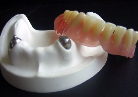 牙松了还有有救吗？是不是必须拔掉？