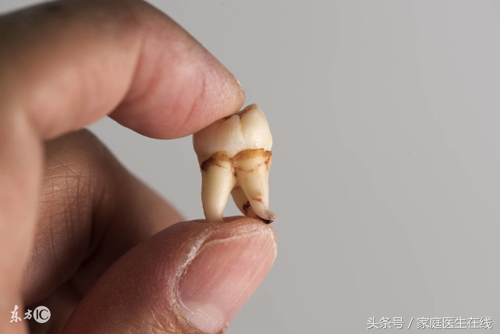 拔智齿的好处和坏处(拔智齿的好处和坏处不能瘦脸吗)
